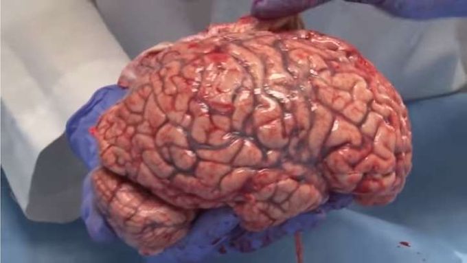 An actual human brain photograph I got from Google to help me determine my color palette for the 'fiend'.